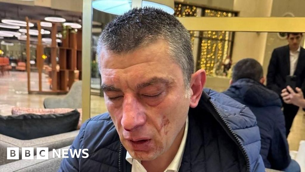 Georgia opposition leader beaten and blamed on ruling party members