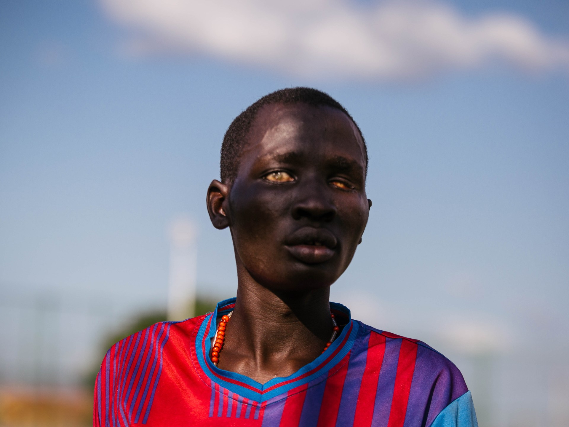 Ouch! I am coming! ”: South Sudan’s blind footballer | Football