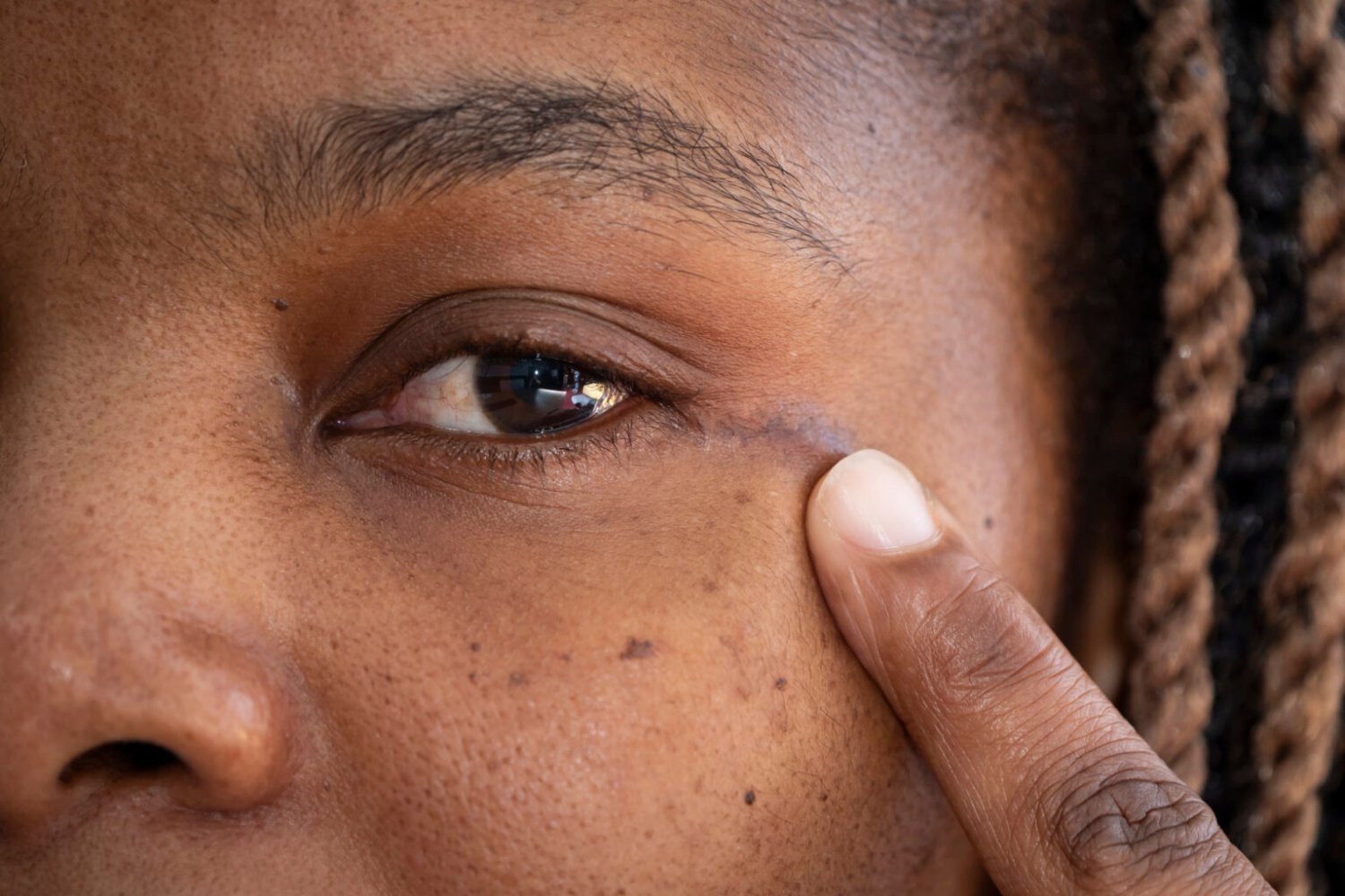 Surgeons Make History by Removing a Woman’s Brain Tumor Through Her Eye