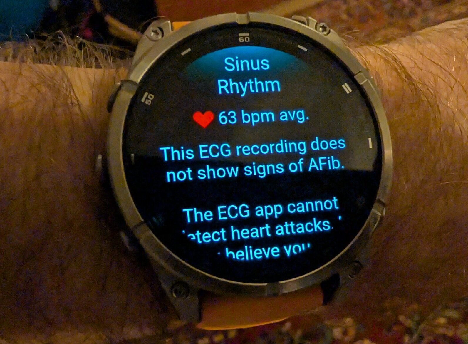 GSIP GPS watches are bricing and know nothing about why